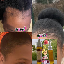 Charger l'image dans la galerie, Huile traite-alopécie